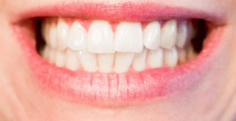 Teeth Whitening in Richmond