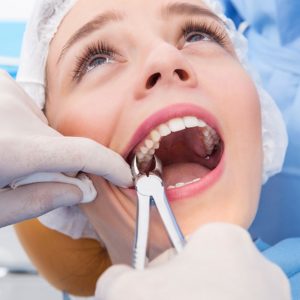 Tooth Extraction Richmond BC - Wisdom Tooth Removal Richmond BC